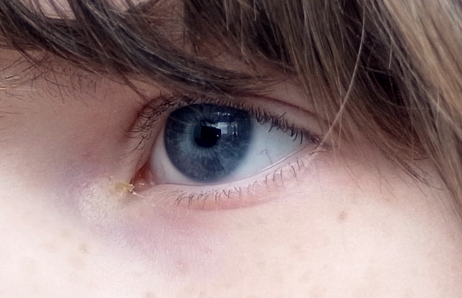 Heliar_2,5-75mm_Detail.jpg